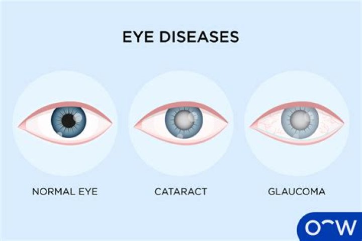 How can I tell what diseases I have?