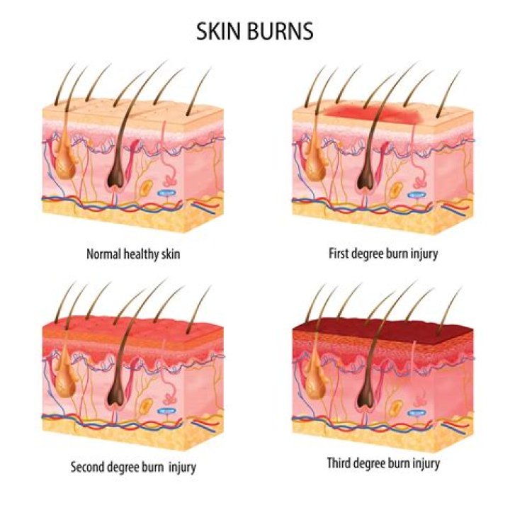 How much damage does after burn do?