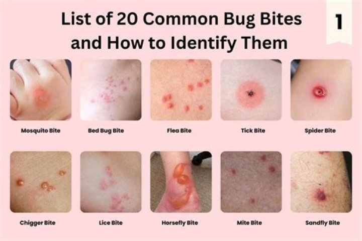 How often do zombies bite plants and how many bites can normal plants take?