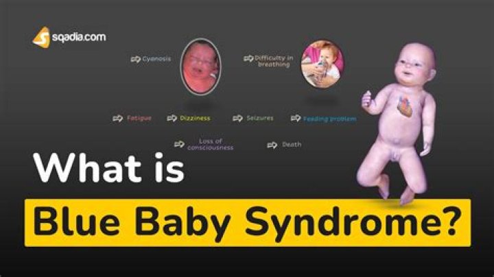 Why will ???/Bluebaby not unlock?